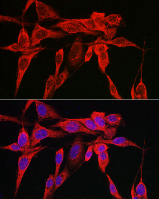 Immunofluorescence analysis of U2OS cells using IRE1 Polyclonal Antibody at dilution of 1:100 (40x lens). Blue: DAPI for nuclear staining.