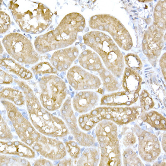 Immunohistochemistry of paraffin-embedded mouse kidney using IRE1 Polyclonal Antibody at dilution of 1:100 (40x lens).Perform high pressure antigen retrieval with 10 mM citrate buffer pH 6.0 before commencing with IHC staining protocol.