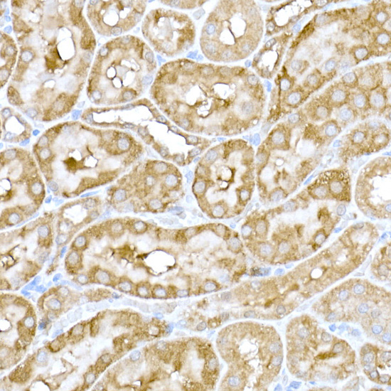 Immunohistochemistry of paraffin-embedded rat kidney using IRE1 Polyclonal Antibody at dilution of 1:100 (40x lens).Perform high pressure antigen retrieval with 10 mM citrate buffer pH 6.0 before commencing with IHC staining protocol.