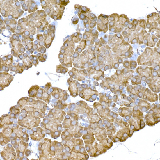 Immunohistochemistry of paraffin-embedded rat pancreas using IRE1 Polyclonal Antibody at dilution of 1:100 (40x lens).Perform high pressure antigen retrieval with 10 mM citrate buffer pH 6.0 before commencing with IHC staining protocol.