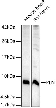 Western blot analysis of extracts of various cell lines using PLN Polyclonal Antibody at 1:500 dilution.