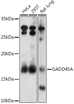 Western blot analysis of extracts of various cell lines using GADD45A Polyclonal Antibody at 1:1000 dilution.