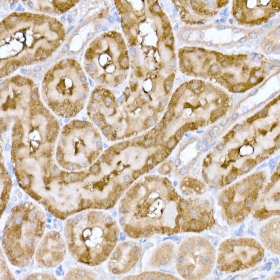 Immunohistochemistry of paraffin-embedded rat kidney using MT-ND6 Polyclonal Antibody at dilution of 1:100 (40x lens).Perform high pressure antigen retrieval with 10 mM citrate buffer pH 6.0 before commencing with IHC staining protocol.