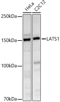 Western blot analysis of extracts of various cell lines using LATS1 Polyclonal Antibody at 1:1000 dilution.