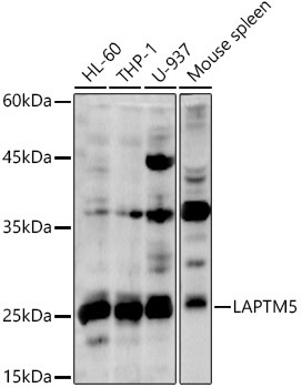 Western blot analysis of extracts of various cell lines using LAPTM5 Polyclonal Antibody at 1:1000 dilution.