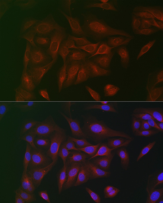 Immunofluorescence analysis of U2OS cells using IL6ST Polyclonal Antibody at dilution of 1:100. Blue: DAPI for nuclear staining.