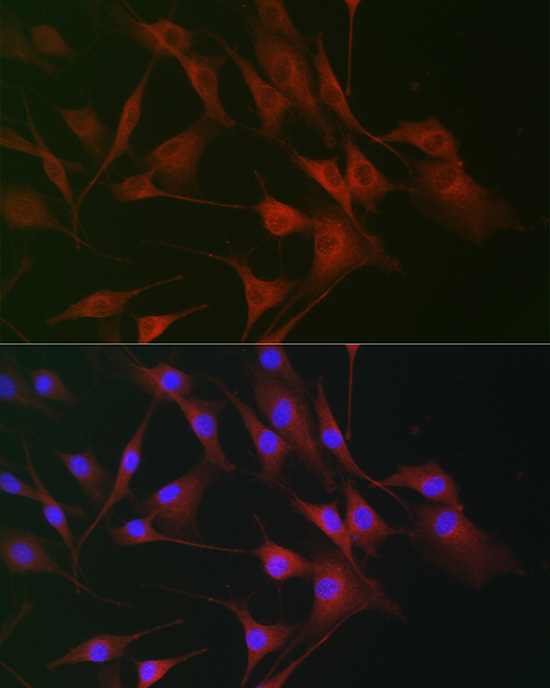 Immunofluorescence analysis of NIH/3T3 cells using IL6ST Polyclonal Antibody at dilution of 1:100. Blue: DAPI for nuclear staining.