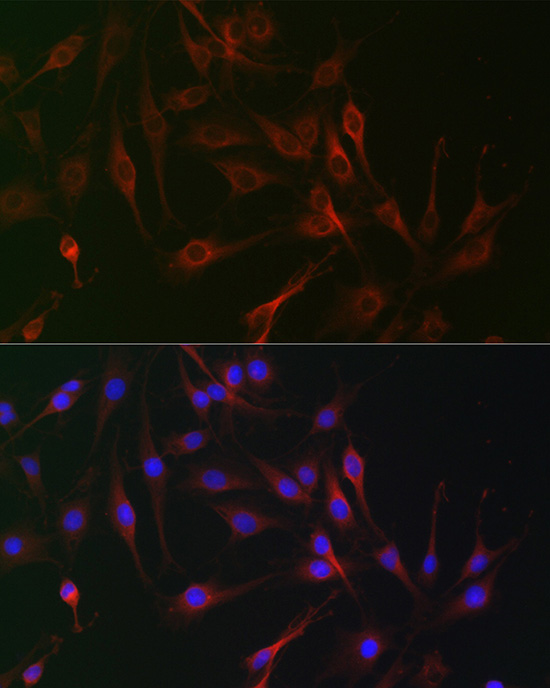 Immunofluorescence analysis of C6 cells using IL6ST Polyclonal Antibody at dilution of 1:100. Blue: DAPI for nuclear staining.