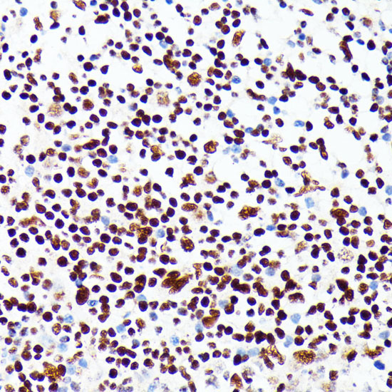 Immunohistochemistry of paraffin-embedded human appendix using PML Polyclonal Antibody at dilution of 1:100 (40x lens).Perform microwave antigen retrieval with 10 mM PBS buffer pH 7.2 before commencing with IHC staining protocol.