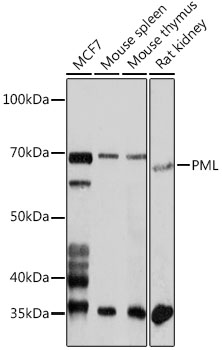 Western blot analysis of extracts of various cell lines using PML Polyclonal Antibody at 1:1000 dilution.