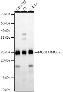 Western blot analysis of extracts of RAW264.7 cells using iNOS Polyclonal Antibody at 1:1000 dilution.Raw264.7 cells were treated by LPS (1 μg/ml) at 37℃ for 8 hours.