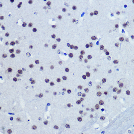 Immunohistochemistry of paraffin-embedded Mouse brain using Vgll4 Polyclonal Antibody at dilution of 1:100 (40x lens).Perform microwave antigen retrieval with 10 mM Tris/EDTA buffer pH 9.0 before commencing with IHC staining protocol.