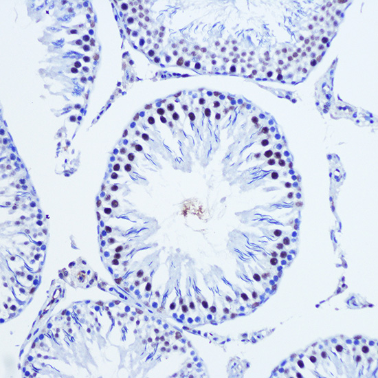 Immunohistochemistry of paraffin-embedded Rat testis using Vgll4 Polyclonal Antibody at dilution of 1:100 (20x lens).Perform microwave antigen retrieval with 10 mM Tris/EDTA buffer pH 9.0 before commencing with IHC staining protocol.