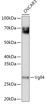 Western blot analysis of extracts of OVCAR3 cells using Vgll4 Polyclonal Antibody at 1:1000 dilution.