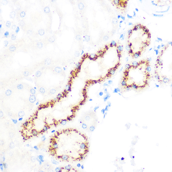 Immunohistochemistry of paraffin-embedded rat kidney using OSR1 Polyclonal Antibody at dilution of 1:100 (40x lens).Perform microwave antigen retrieval with 10 mM PBS buffer pH 7.2 before commencing with IHC staining protocol.