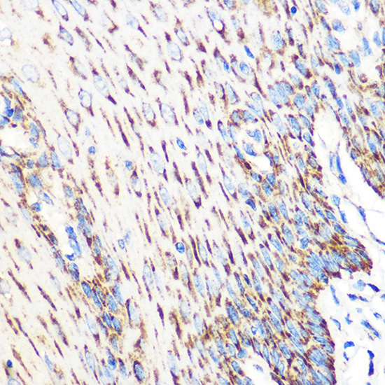 Immunohistochemistry of paraffin-embedded human esophageal using OSR1 Polyclonal Antibody at dilution of 1:100 (40x lens).Perform microwave antigen retrieval with 10 mM PBS buffer pH 7.2 before commencing with IHC staining protocol.