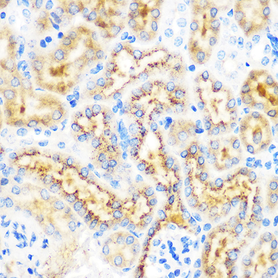 Immunohistochemistry of paraffin-embedded mouse kidney using OSR1 Polyclonal Antibody at dilution of 1:100 (40x lens).Perform microwave antigen retrieval with 10 mM PBS buffer pH 7.2 before commencing with IHC staining protocol.