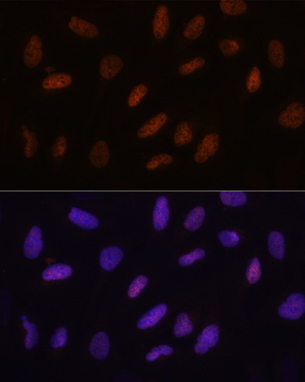 Immunofluorescence analysis of U2OS cells using TET3 Polyclonal Antibody at dilution of 1:100. Blue: DAPI for nuclear staining.