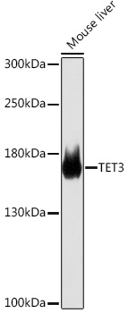 Western blot analysis of extracts of Mouse liver using TET3 Polyclonal Antibody at 1:1000 dilution.