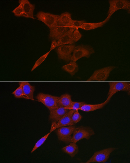 Immunofluorescence analysis of U2OS cells using JAK1 Polyclonal Antibody at dilution of 1:300 (40x lens). Blue: DAPI for nuclear staining.