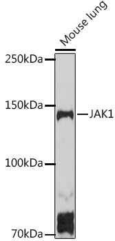 Western blot analysis of extracts of Mouse lung using JAK1 Polyclonal Antibody at 1:1000 dilution.