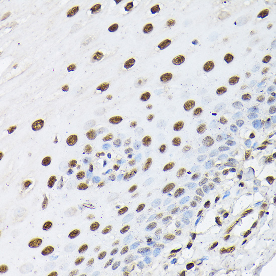 Immunohistochemistry of paraffin-embedded human esophageal using Histone H1t Polyclonal Antibody at dilution of 1:100 (40x lens).Perform high pressure antigen retrieval with 10 mM citrate buffer pH 6.0 before commencing with IHC staining protocol.