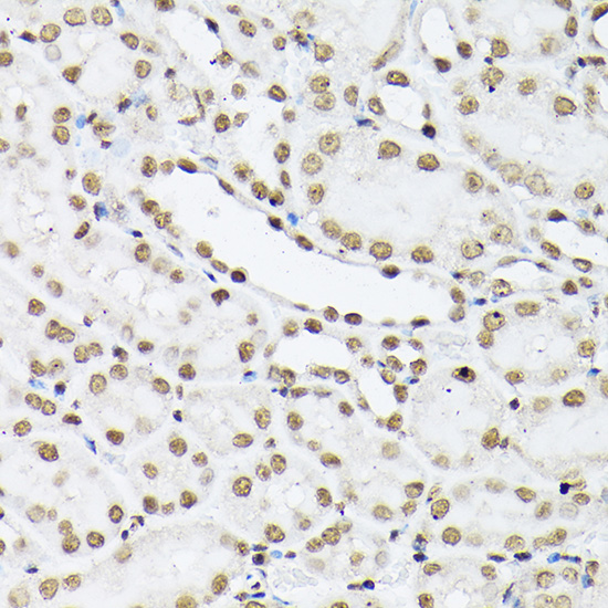 Immunohistochemistry of paraffin-embedded mouse kidney using Histone H1t Polyclonal Antibody at dilution of 1:100 (40x lens).Perform high pressure antigen retrieval with 10 mM citrate buffer pH 6.0 before commencing with IHC staining protocol.