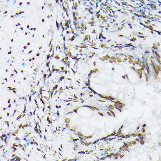 Immunohistochemistry of paraffin-embedded rat lung using Histone H1t Polyclonal Antibody at dilution of 1:100 (40x lens).Perform high pressure antigen retrieval with 10 mM citrate buffer pH 6.0 before commencing with IHC staining protocol.