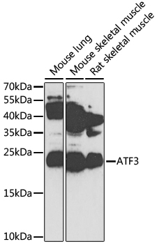 Western blot analysis of extracts of various cell lines using ATF3 Polyclonal Antibody at 1:1000 dilution.