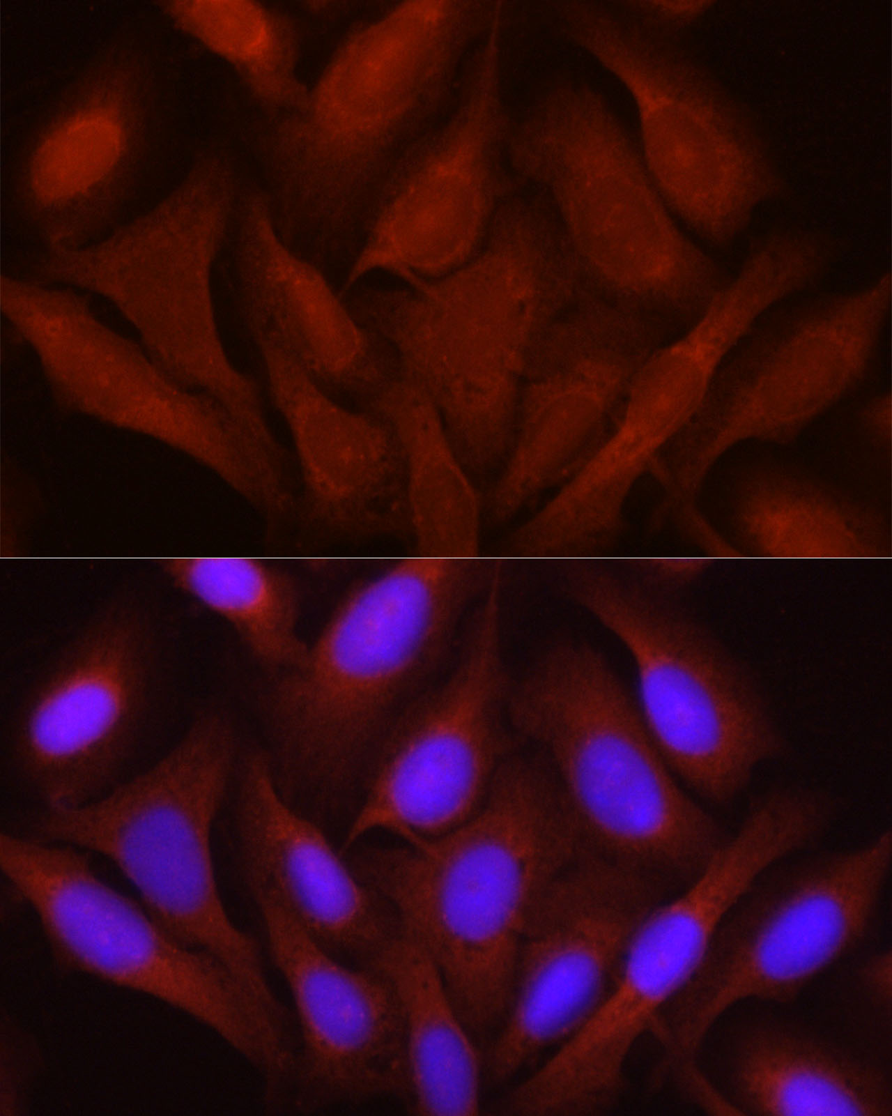 Immunofluorescence analysis of U2OS cells using JNK1/2/3 Polyclonal Antibody at dilution of 1:100 (40x lens). Blue: DAPI for nuclear staining.