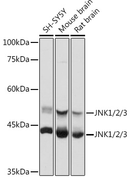 Western blot analysis of extracts of various cell lines using JNK1/2/3 Polyclonal Antibody at 1:1000 dilution.