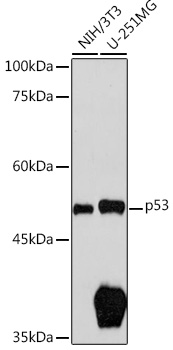 Western blot analysis of extracts of various cell lines using p53 Polyclonal Antibody at 1:1000 dilution.