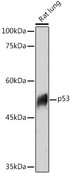 Western blot analysis of extracts of Rat lung using p53 Polyclonal Antibody at 1:1000 dilution.