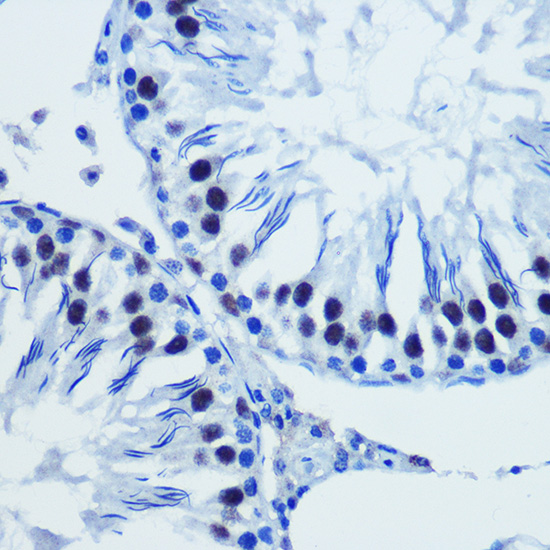 Immunohistochemistry of paraffin-embedded human stomach using BRD4 Polyclonal Antibody at dilution of 1:100 (40x lens).Perform microwave antigen retrieval with 10 mM PBS buffer pH 7.2 before commencing with IHC staining protocol.