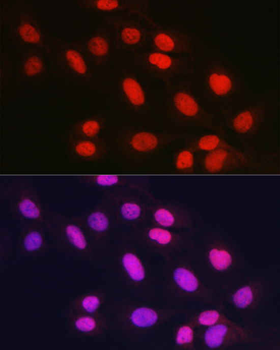 Immunofluorescence analysis of U2OS cells using Rad21 Polyclonal Antibody at dilution of 1:100 (40x lens). Blue: DAPI for nuclear staining.