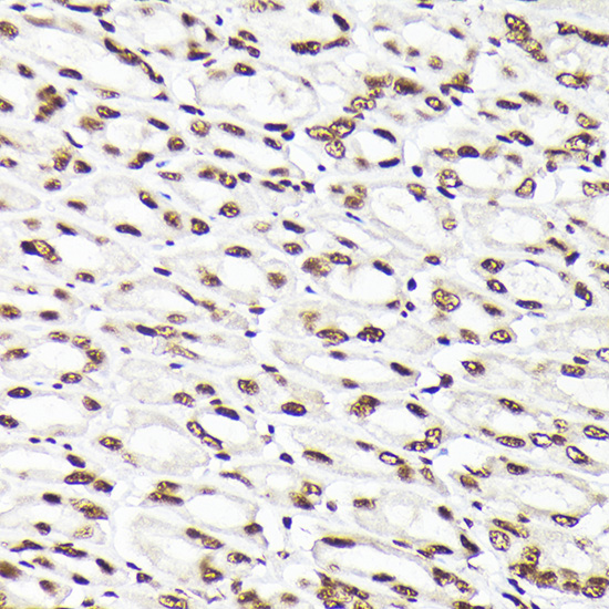 Immunohistochemistry of paraffin-embedded mouse stomach using Rad21 Polyclonal Antibody at dilution of 1:200 (40x lens).Perform high pressure antigen retrieval with 10 mM citrate buffer pH 6.0 before commencing with IHC staining protocol.