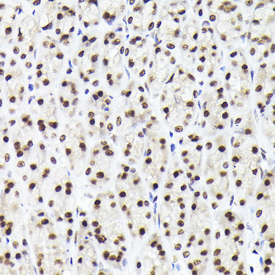 Immunohistochemistry of paraffin-embedded rat stomach using Rad21 Polyclonal Antibody at dilution of 1:200 (40x lens).Perform high pressure antigen retrieval with 10 mM citrate buffer pH 6.0 before commencing with IHC staining protocol.