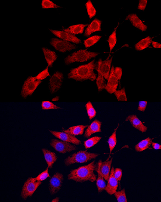 Immunofluorescence analysis of NIH/3T3 cells using CXCL10/IP-10 Polyclonal Antibody at dilution of 1:200 (40x lens). Blue: DAPI for nuclear staining.