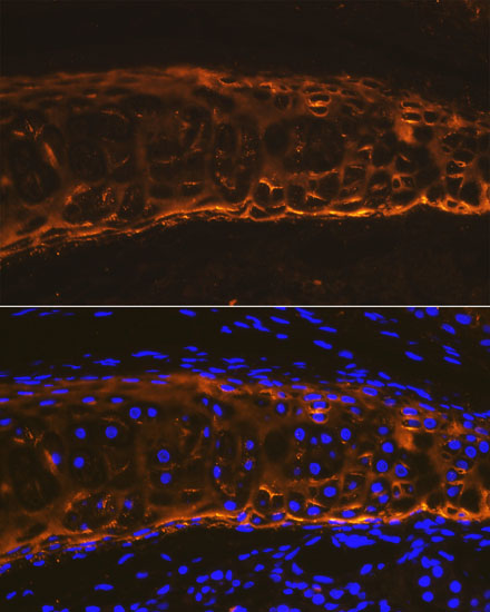 Immunofluorescence analysis of rat trachea using COL2A1 Polyclonal Antibody at dilution of 1:100. Blue: DAPI for nuclear staining.