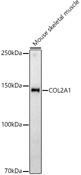 Western blot analysis of extracts of Mouse skeletal muscle using COL2A1 Polyclonal Antibody at 1:400 dilution.