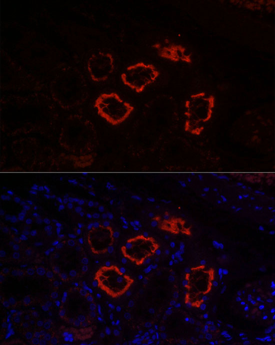 Immunofluorescence analysis of Rat kidney using SLC5A2 Polyclonal Antibody at dilution of 1:100 (40x lens). Blue: DAPI for nuclear staining.