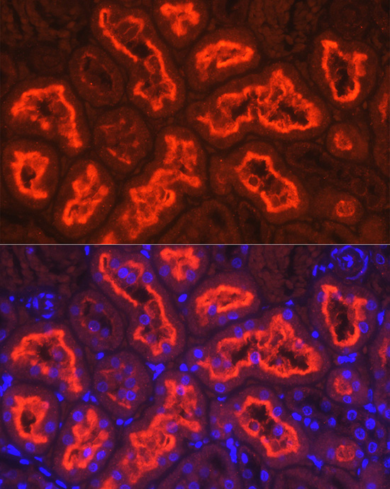 Immunofluorescence analysis of rat kidney cells using SLC5A2 Polyclonal Antibody at dilution of 1:100 (40x lens). Blue: DAPI for nuclear staining.