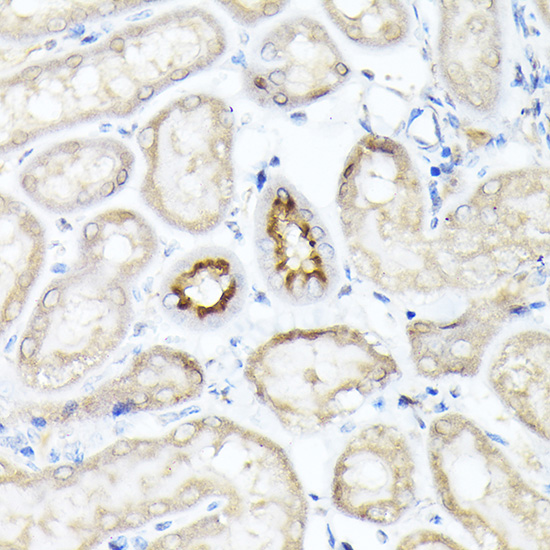 Immunohistochemistry of paraffin-embedded mouse kidney using SLC5A2 Polyclonal Antibody at dilution of 1:100 (40x lens).Perform high pressure antigen retrieval with 10 mM citrate buffer pH 6.0 before commencing with IHC staining protocol.