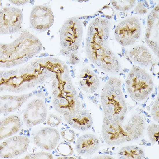 Immunohistochemistry of paraffin-embedded rat kidney using SLC5A2 Polyclonal Antibody at dilution of 1:100 (40x lens).Perform high pressure antigen retrieval with 10 mM citrate buffer pH 6.0 before commencing with IHC staining protocol.