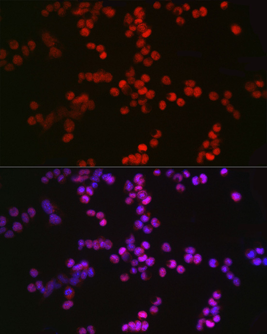 Immunofluorescence analysis of F9 cells using TET2 Polyclonal Antibody at dilution of 1:100 (40x lens). Blue: DAPI for nuclear staining.