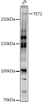 Western blot analysis of extracts of F9 cells using TET2 Polyclonal Antibody at 1:1000 dilution.