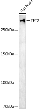 Western blot analysis of extracts of Rat brain using TET2 Polyclonal Antibody at 1:1000 dilution.