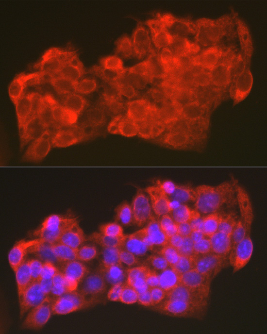 Immunofluorescence analysis of HepG2 cells using PLIN5 Polyclonal Antibody at dilution of 1:100 (40x lens). Blue: DAPI for nuclear staining.