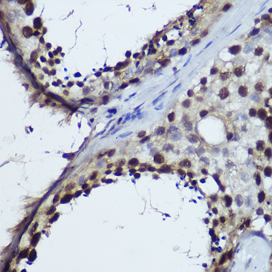 Immunohistochemistry of paraffin-embedded human testis using TET1 Polyclonal Antibody at dilution of 1:100 (40x lens).Perform high pressure antigen retrieval with 10 mM citrate buffer pH 6.0 before commencing with IHC staining protocol.