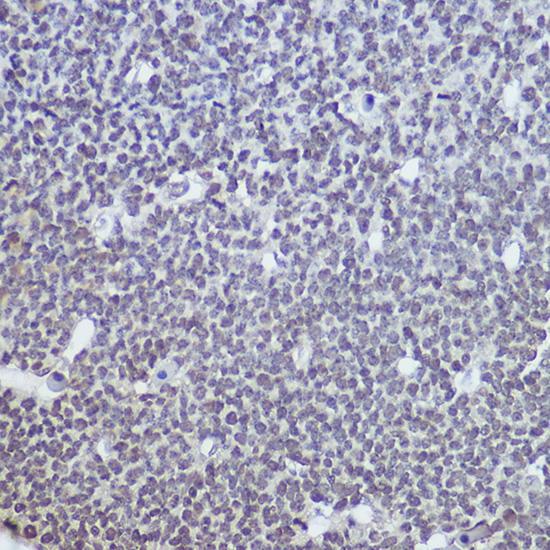 Immunohistochemistry of paraffin-embedded mouse embryos using TET1 Polyclonal Antibody at dilution of 1:100 (40x lens).Perform high pressure antigen retrieval with 10 mM citrate buffer pH 6.0 before commencing with IHC staining protocol.